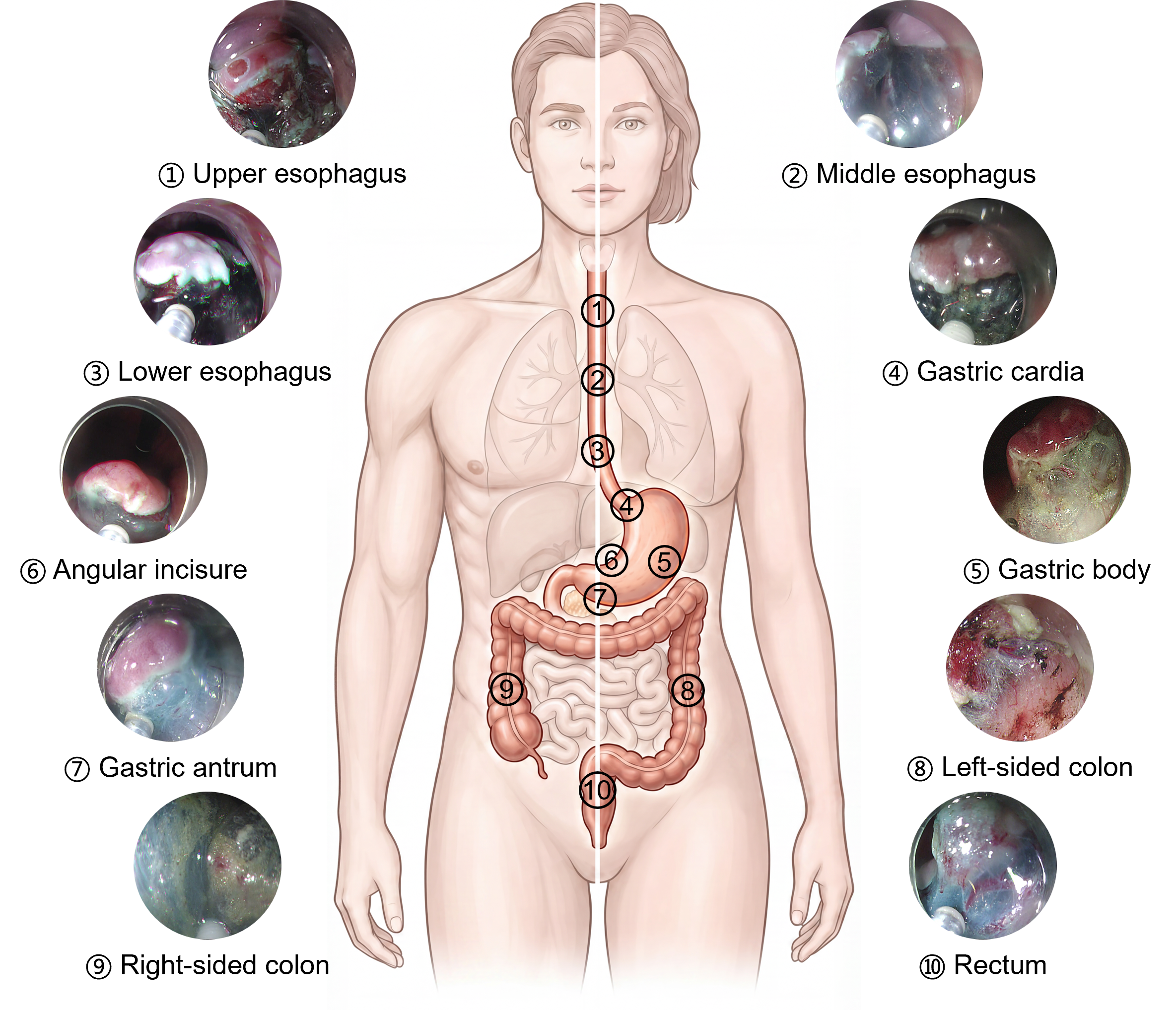 Anatomical map of ten ESD sites across the oesophagus, stomach and colorectum