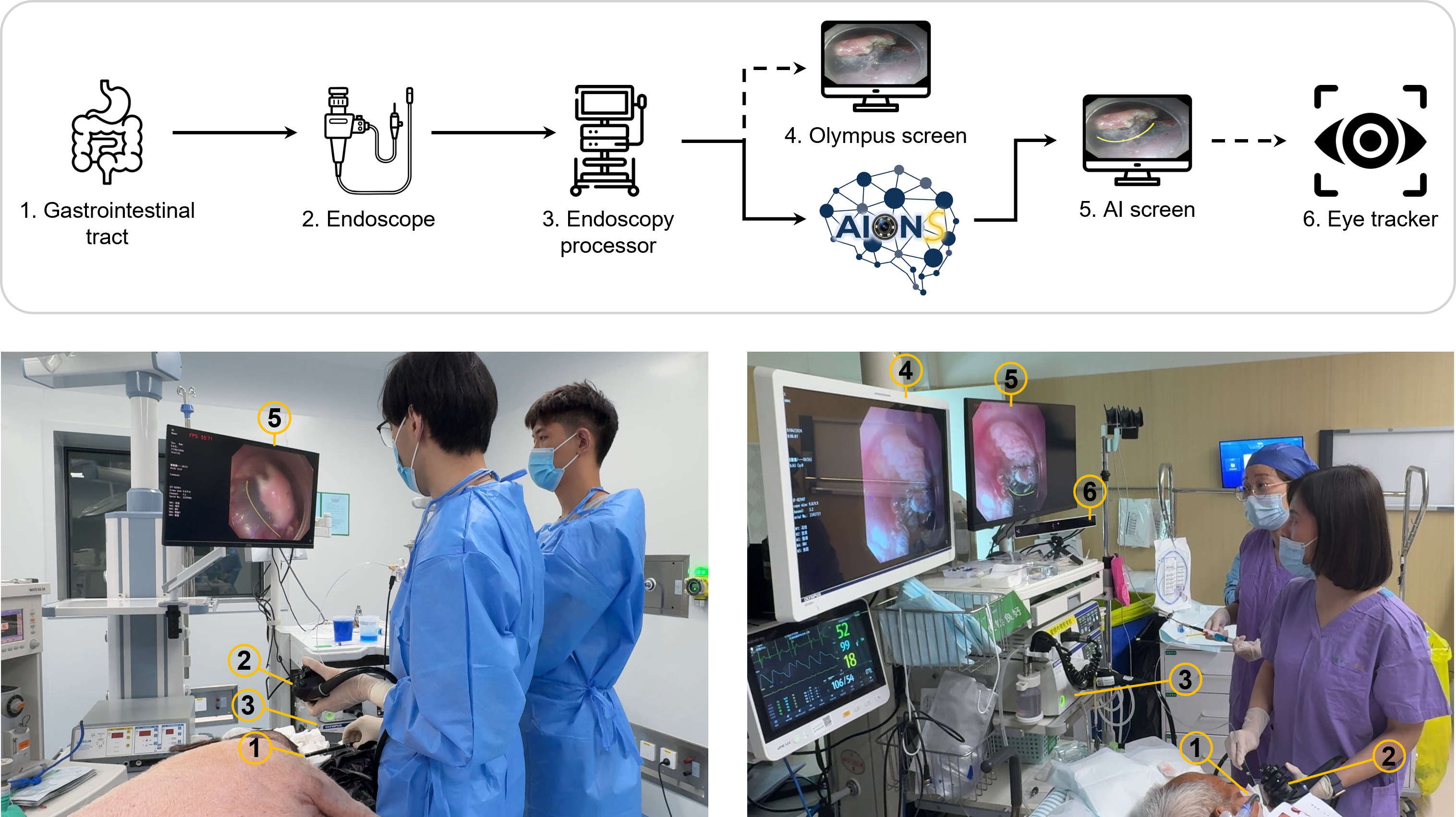System workflow: gastrointestinal tract, endoscope, endoscopy processor, Olympus screen, AIONS, AI screen and eye tracker.