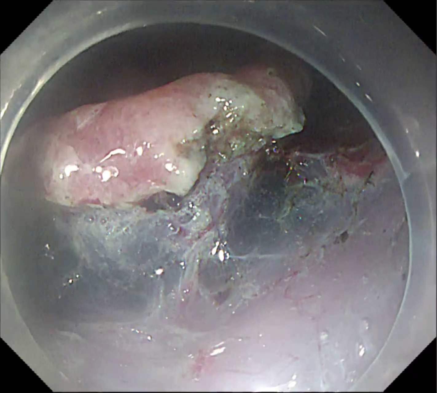 Original endoscopic frame before AIONS guidance