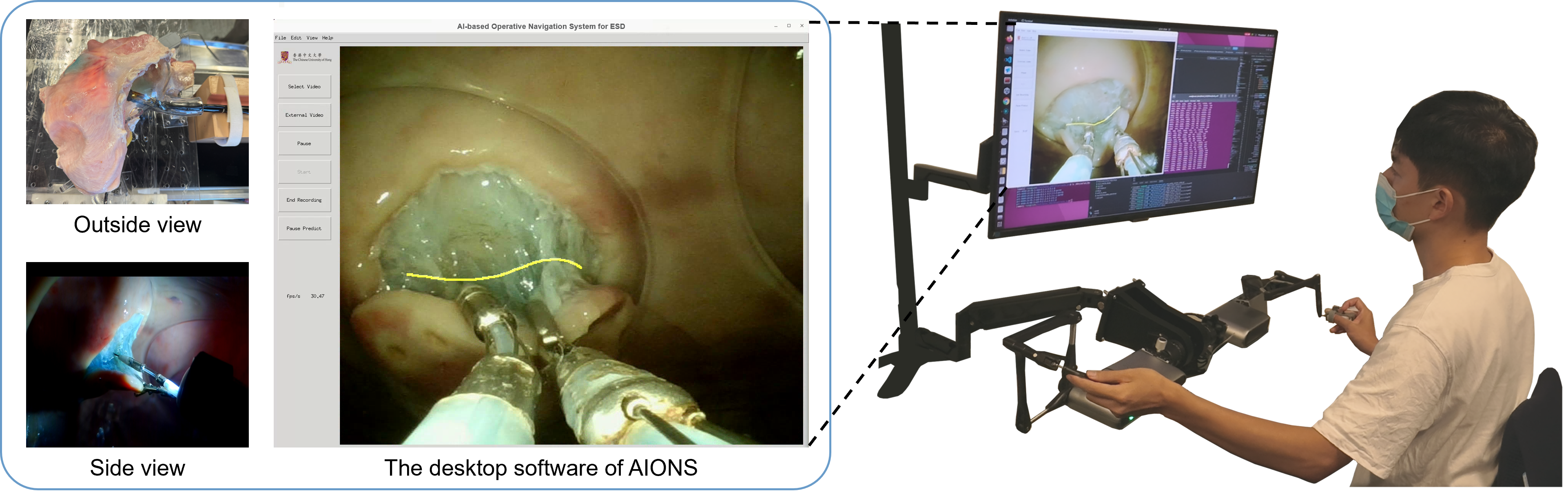 AIONS desktop navigation software, a porcine stomach model and an operator using the dual-arm robotic teleoperation system.